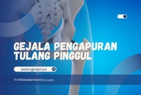 Kenali Gejala dan Penyebab Pengapuran Tulang Pinggul 